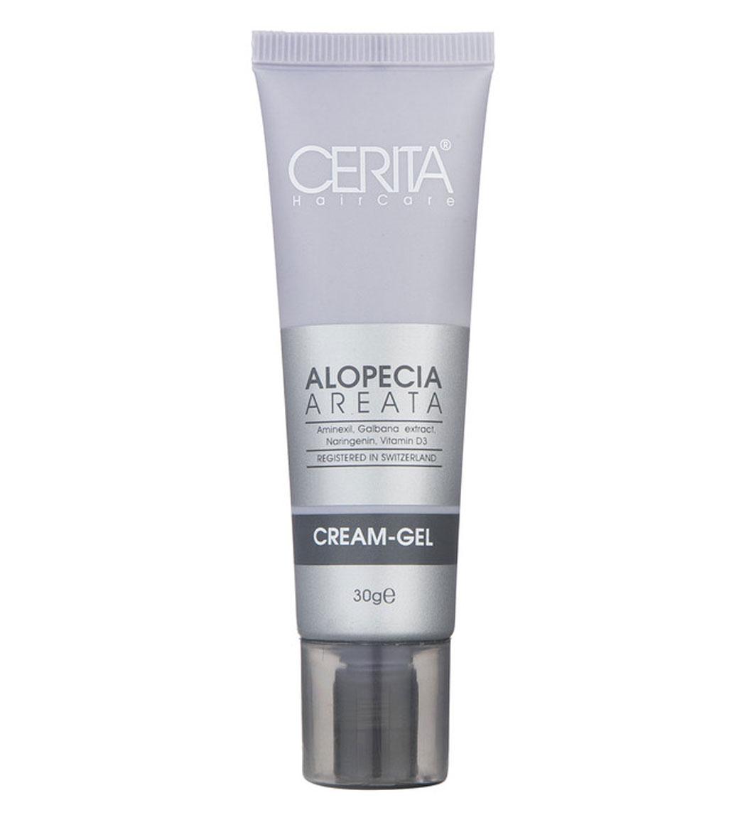 کرم ژل ریزش مو سکه ای آلوپسی آره آتا سریتا